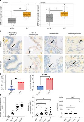 IL11-mediated stromal cell activation may not be the master regulator of pro-fibrotic signaling downstream of TGFβ